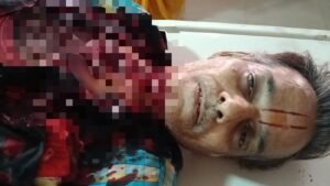 कज्जाकपुरा फ्लाईओवर पर मांझे ने ली बाइक सवार की जान, गले में गंभीर चोट से मौत